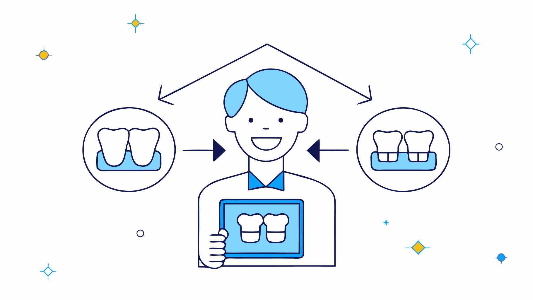 4 Stunning Front Teeth Partial Dentures Pictures to Transform Your Smile