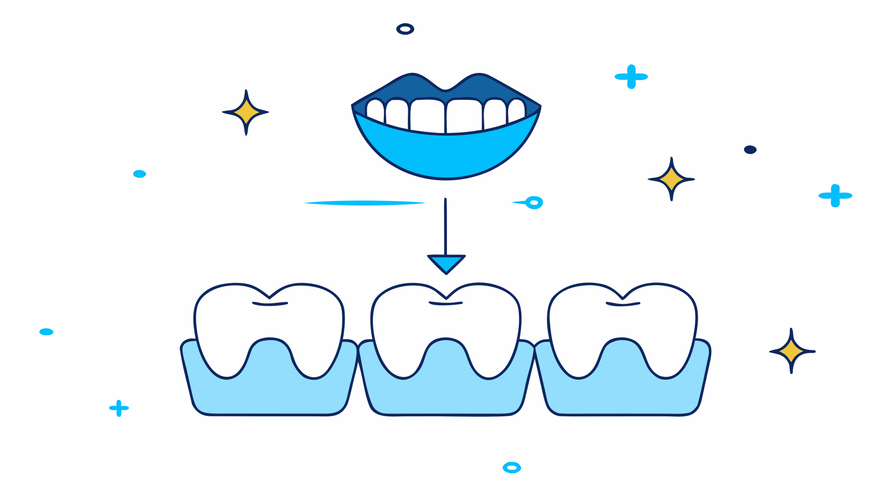 5 Missing Teeth Replacement Options for Busy Professionals