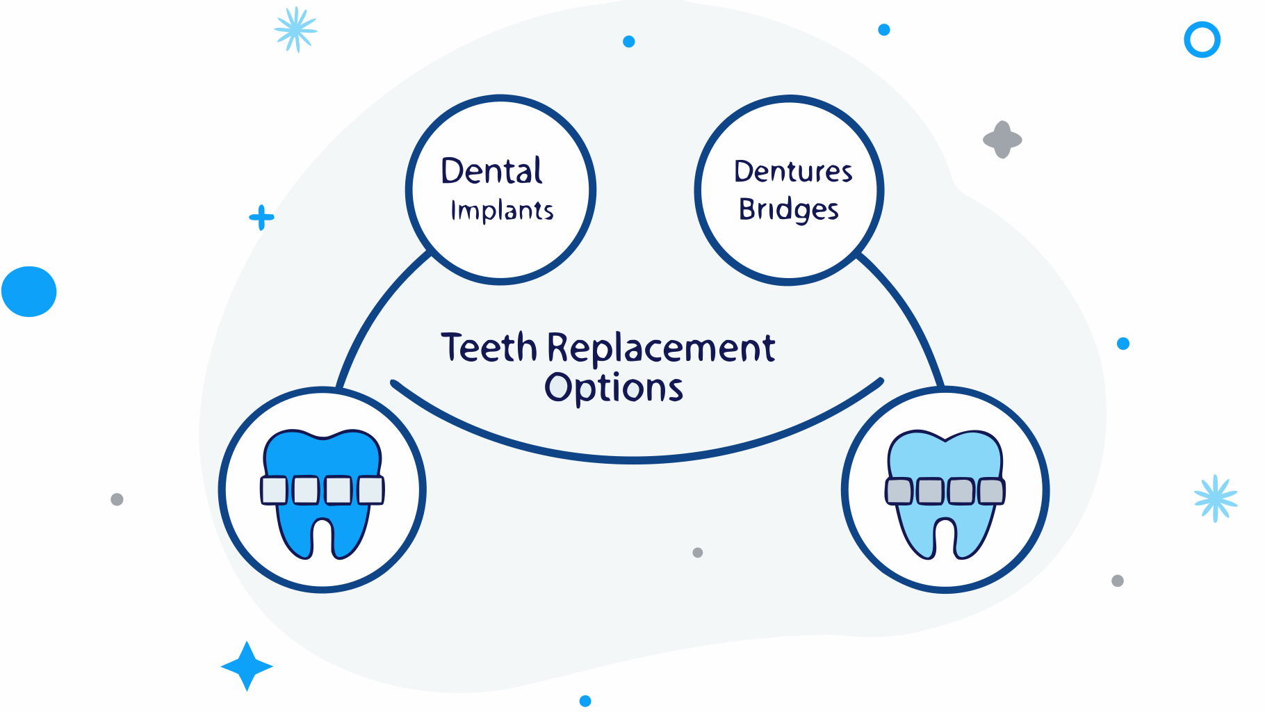 Best Teeth Replacement Options: Compare Implants, Dentures, and Bridges
