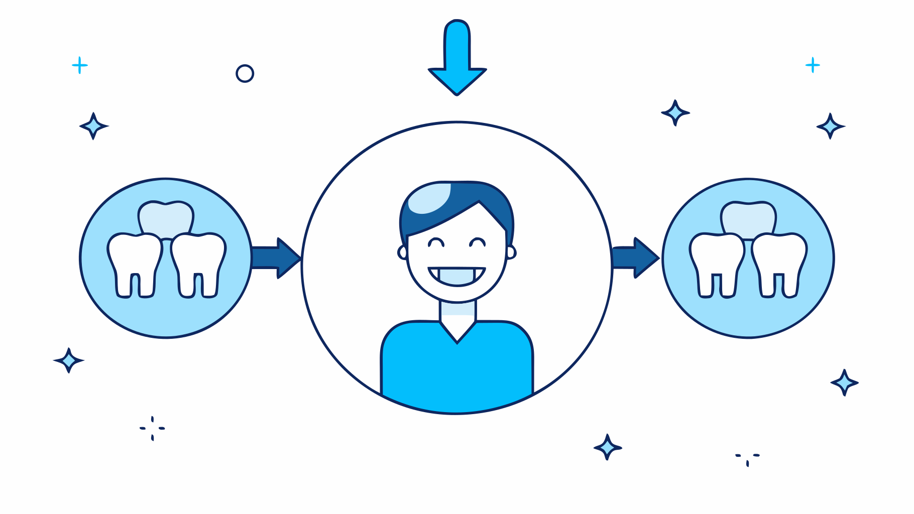 Choose the Best Tooth Replacement: A Step-by-Step Guide