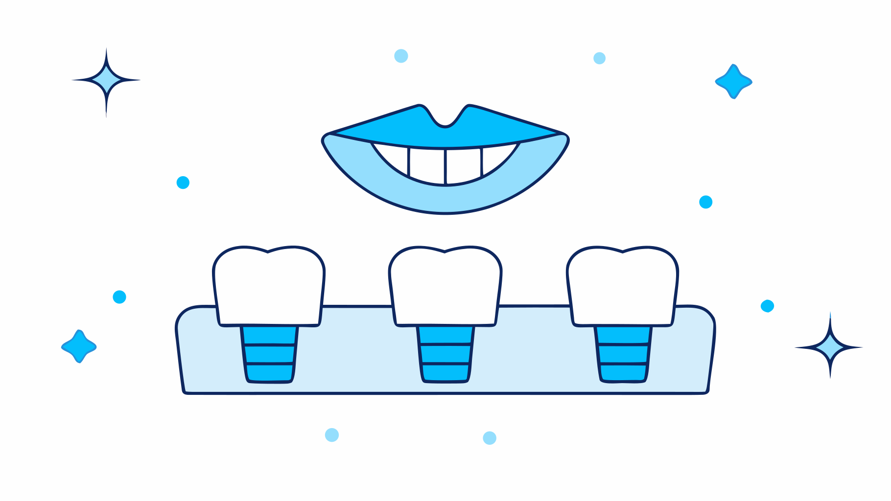Comparing Replacing a Tooth Options: Implants, Bridges, and Dentures