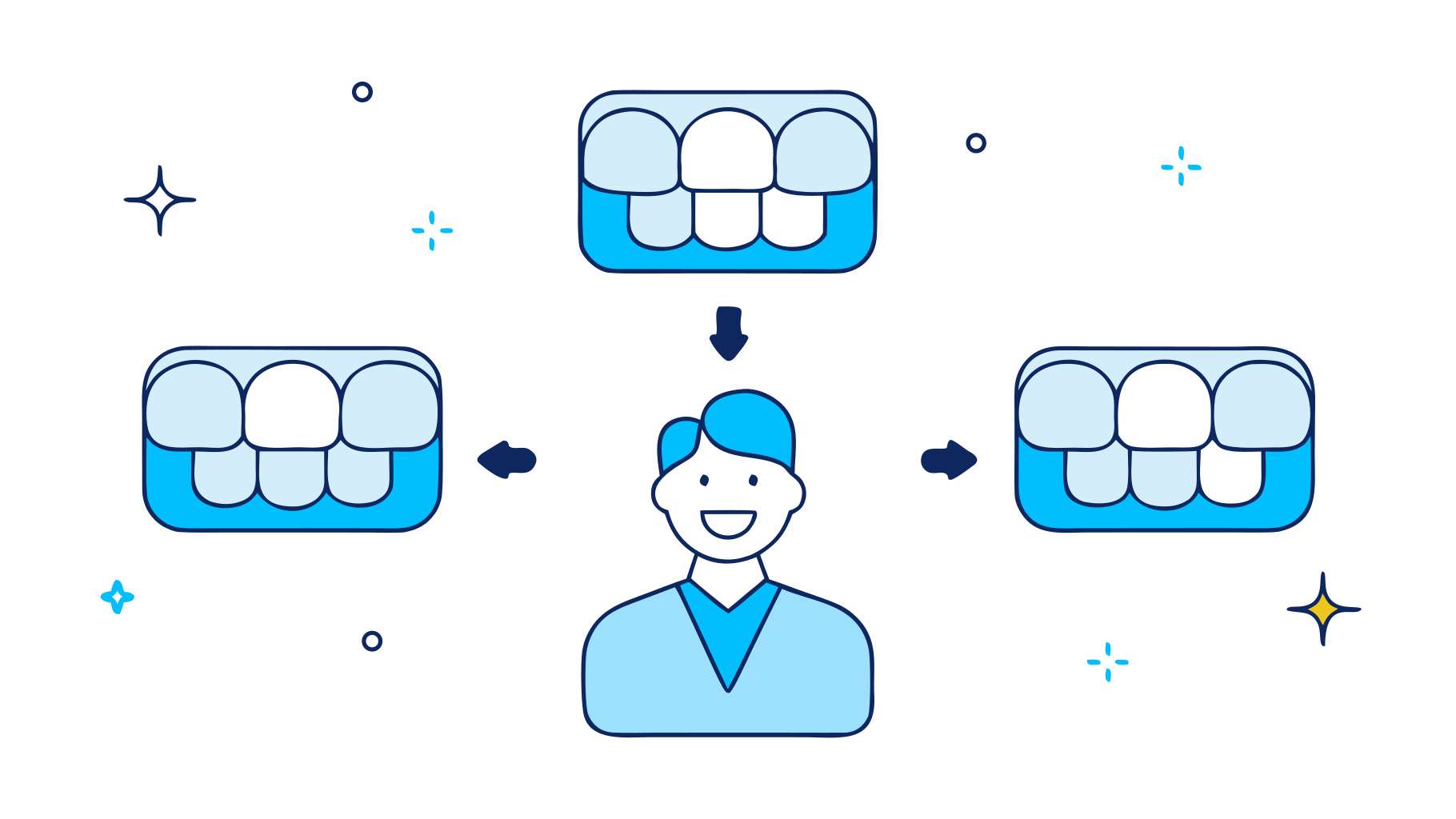 How Long Do Partial Dentures Take to Make? Key Factors Explained