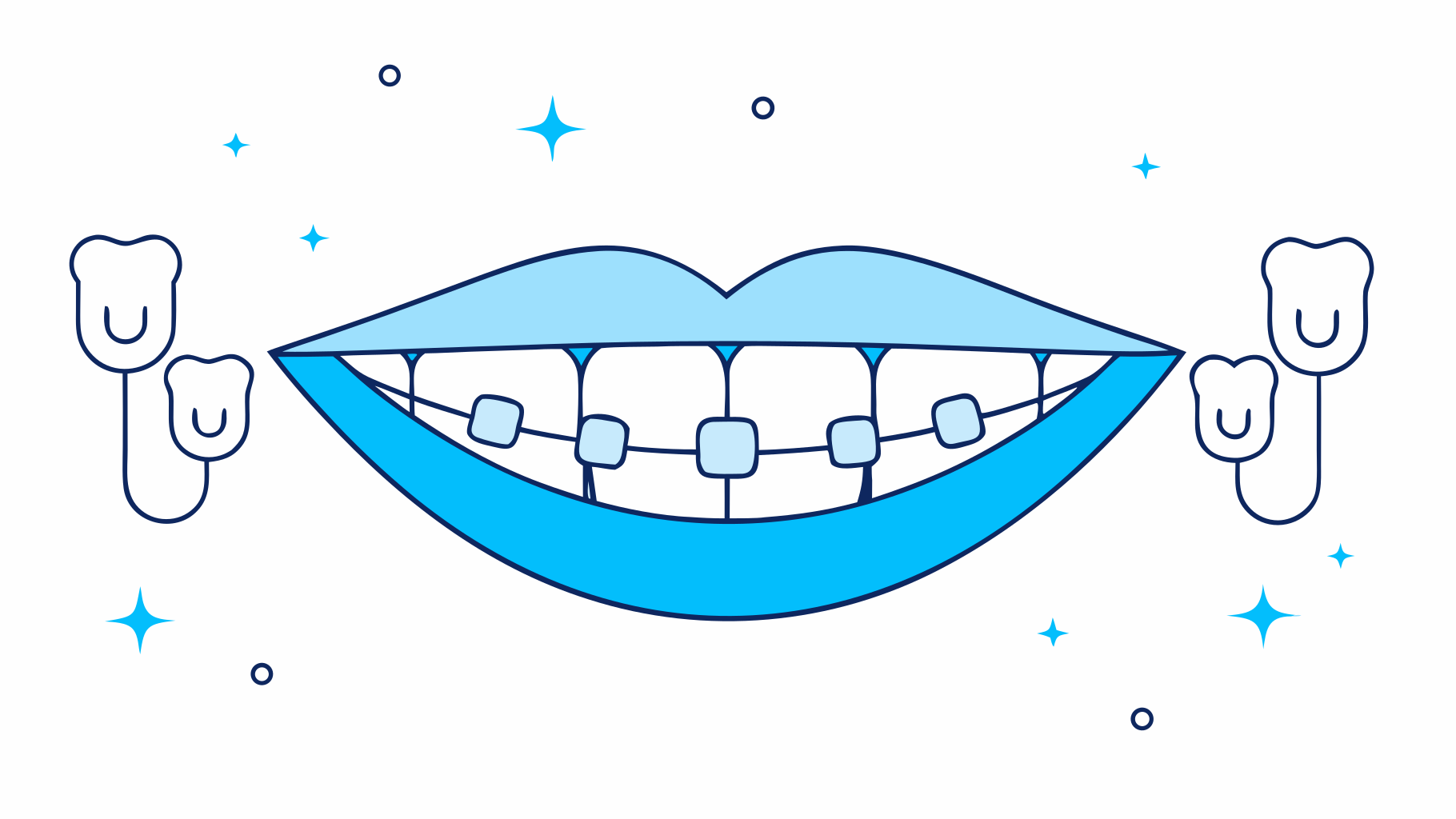 Your Step-by-Step Guide to Metal Partial Dentures
