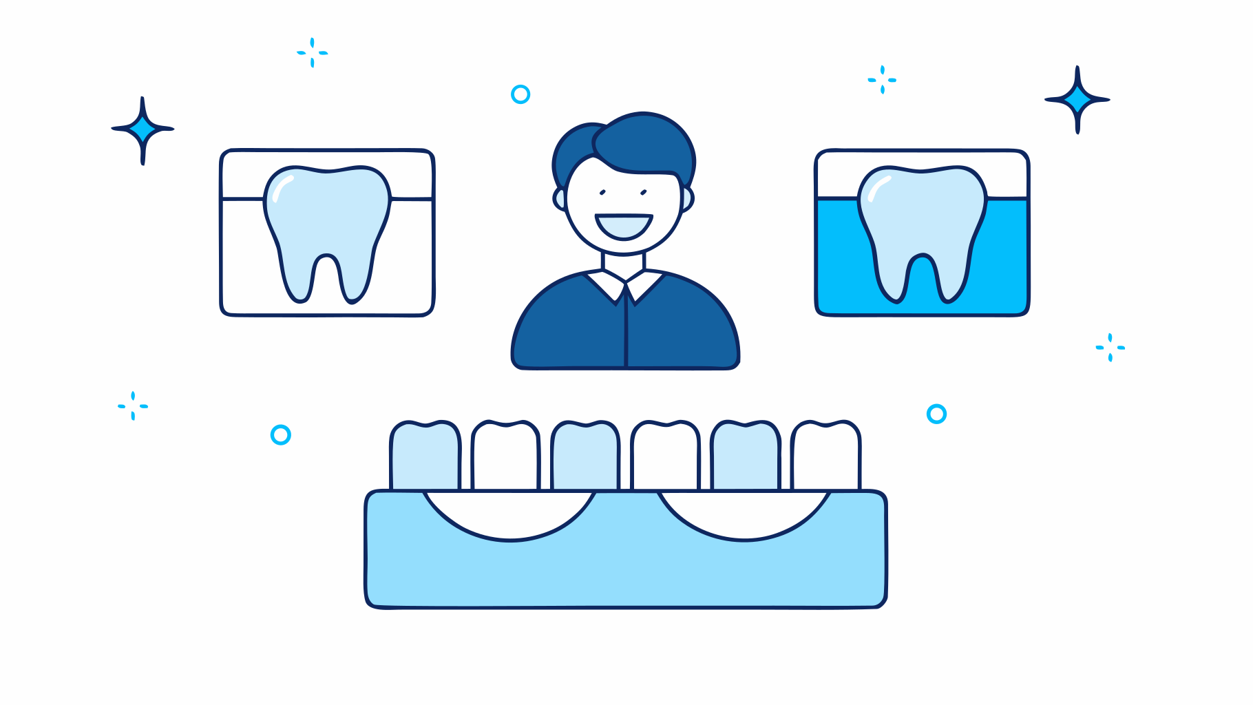 4-steps-to-add-a-tooth-to-your-denture-easily