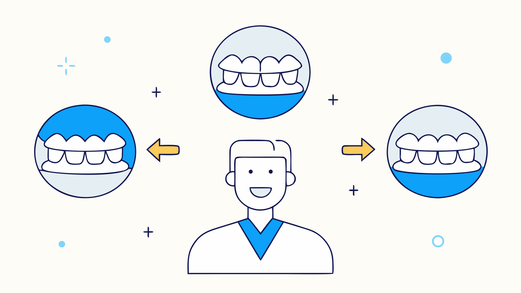 5 Steps to Get Your Custom Dentures Now with DentKits