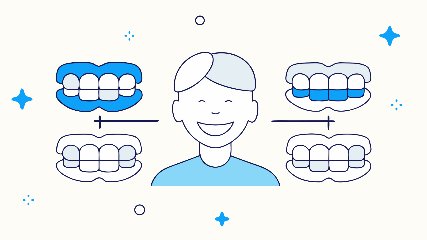New Style Dentures vs. Traditional: Key Differences for Busy Professionals
